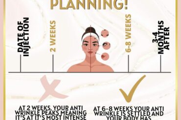 Post Dermal Filler Checklist