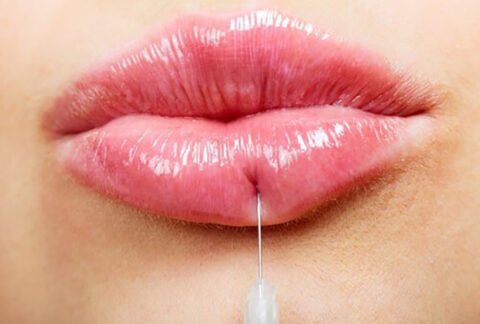 Dermal Fillers
