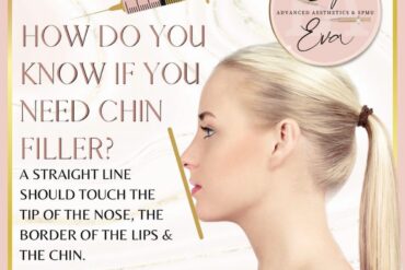 Anti Wrinkle Activity