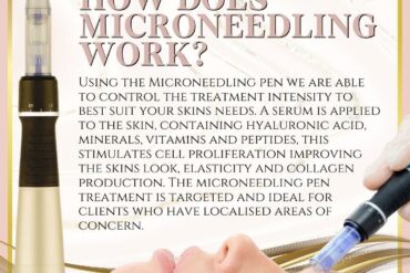 Microneedling Aftercare